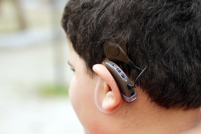 G1 - Aparelho auditivo ajuda paraibanos que têm deficiência auditiva  parcial - notícias em Paraíba